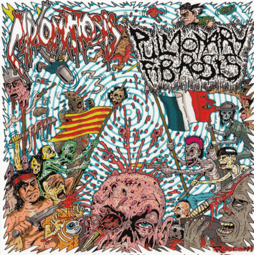 Mixomatosis : Mixomatosis - Pulmonary Fibrosis